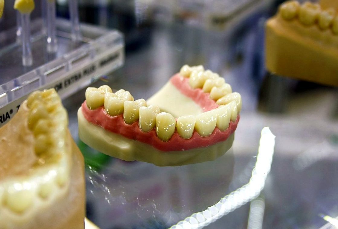Протез на имплантах на рабочей модели